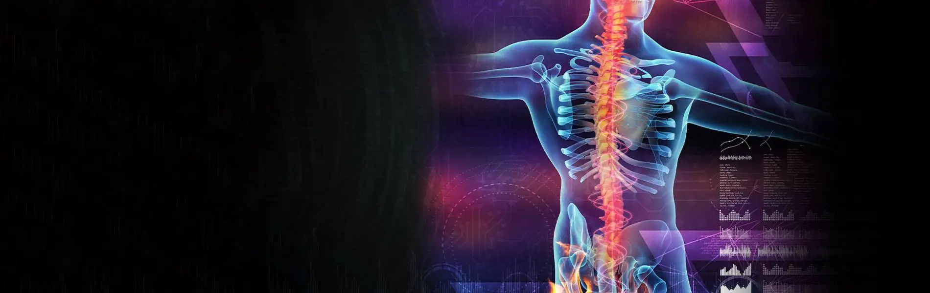 A photo of a patient with spinal compression pain.